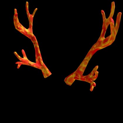 Bombastic Antlers